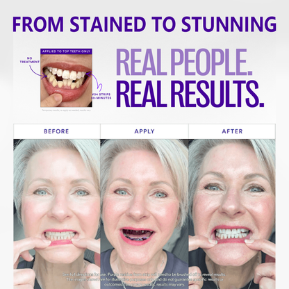✨Clinclii™ V36 Whitening Strips – Professional Teeth Whitening at Home(UPGRADED VERSION)