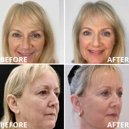 🏆Limited Time Offer🏆—JEREMYTIS™ Calcium Multi-Effect Eye Cream💫 Anti-Aging Firming Eye Treatment Bar🔥