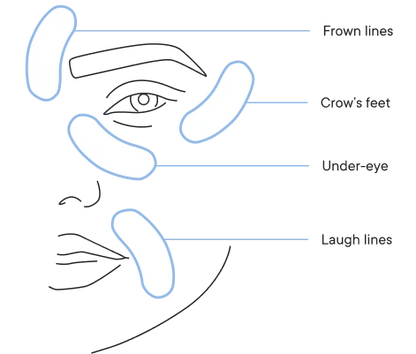 🔥Final 3 hours-60%OFF &Smooth, firm and plump stubborn areas with Microneedle Patch Targeted Patches