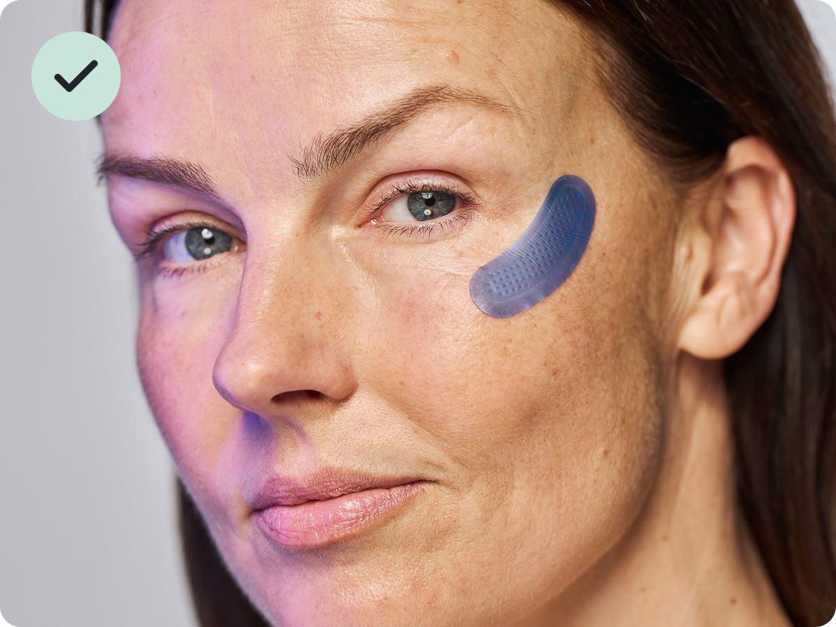 🔥Final 3 hours-60%OFF &Smooth, firm and plump stubborn areas with Microneedle Patch Targeted Patches