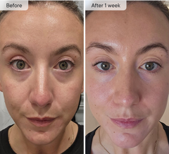 🔥Final 3 hours-60%OFF &Smooth, firm and plump stubborn areas with Microneedle Patch Targeted Patches